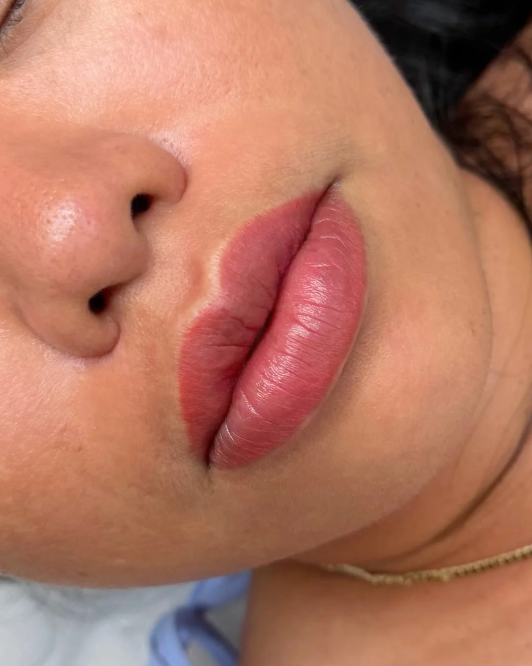 A soft restoration of colour and balance.

This set focused on neutralising uneven tones through the centre of the lips while building a warm, natural pink that blends seamlessly with the client&rsquo;s existing lip.

The result is more even, more de