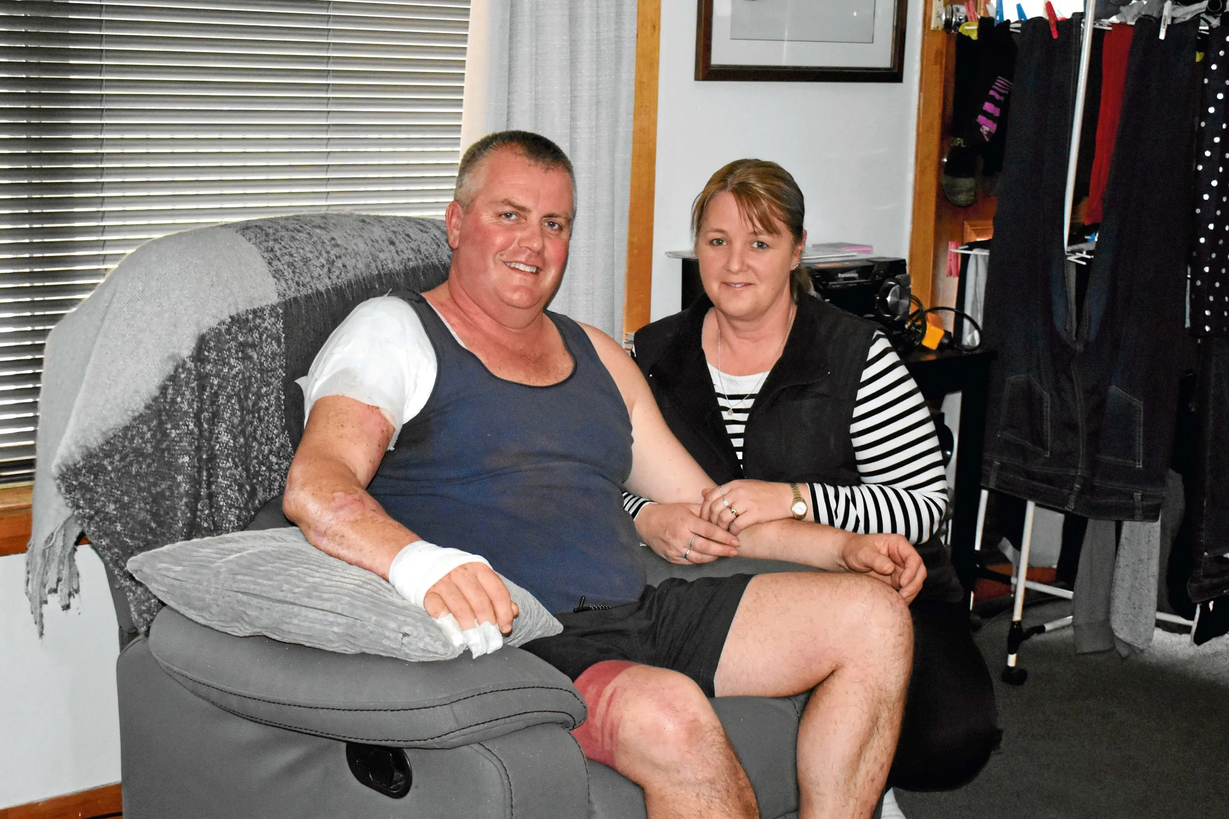 • Burn victim Marcus Casey with his wife Mandi at their home in Scottsdale.