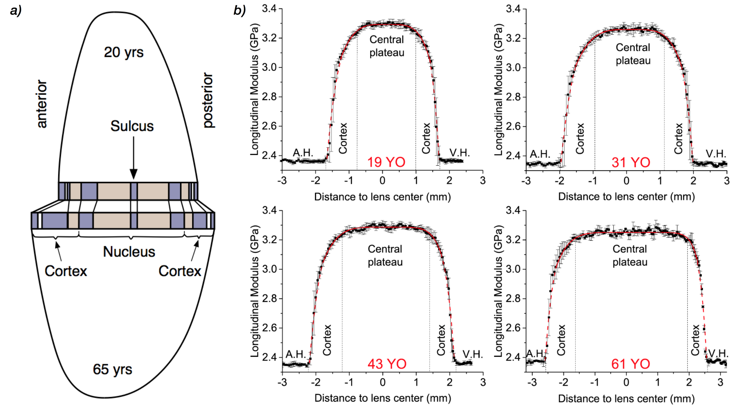 Age-related crystalline lens thickening. a) Model of thickening, b) Crystalline lens stiffness profiles measured with BOSS™ in 19-, 31-, 43-, and 61-year-old human showing the aqueous humor (A.H.), the vitreous humor (V.H.), the lens cortex, and lens nucleus plateau.