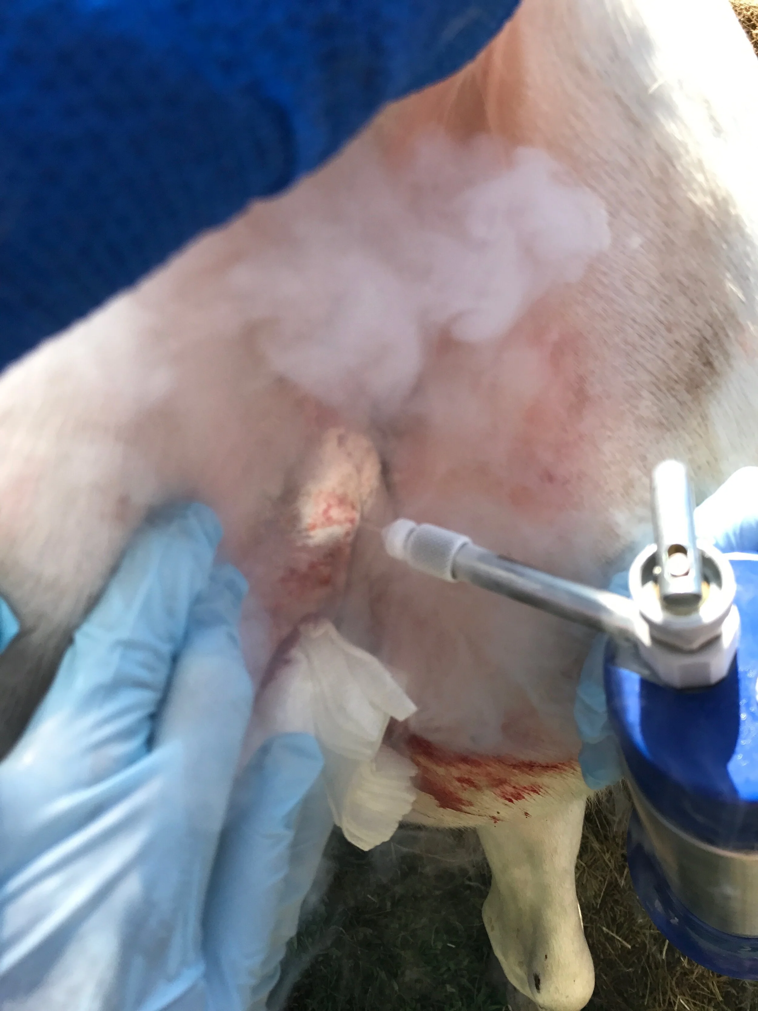 Cryosurgery (2).jpeg