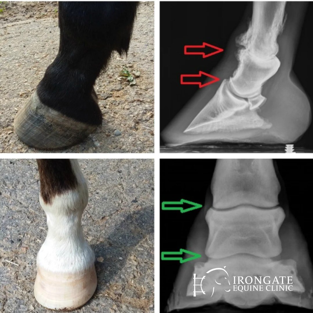 🐴 What is Ringbone in Horses? 🦴

Ringbone is a painful condition where new bone forms in a horse&rsquo;s pastern or coffin joints. It&rsquo;s most common in middle-aged horses, especially those with certain conformation or heavy joint stress from a