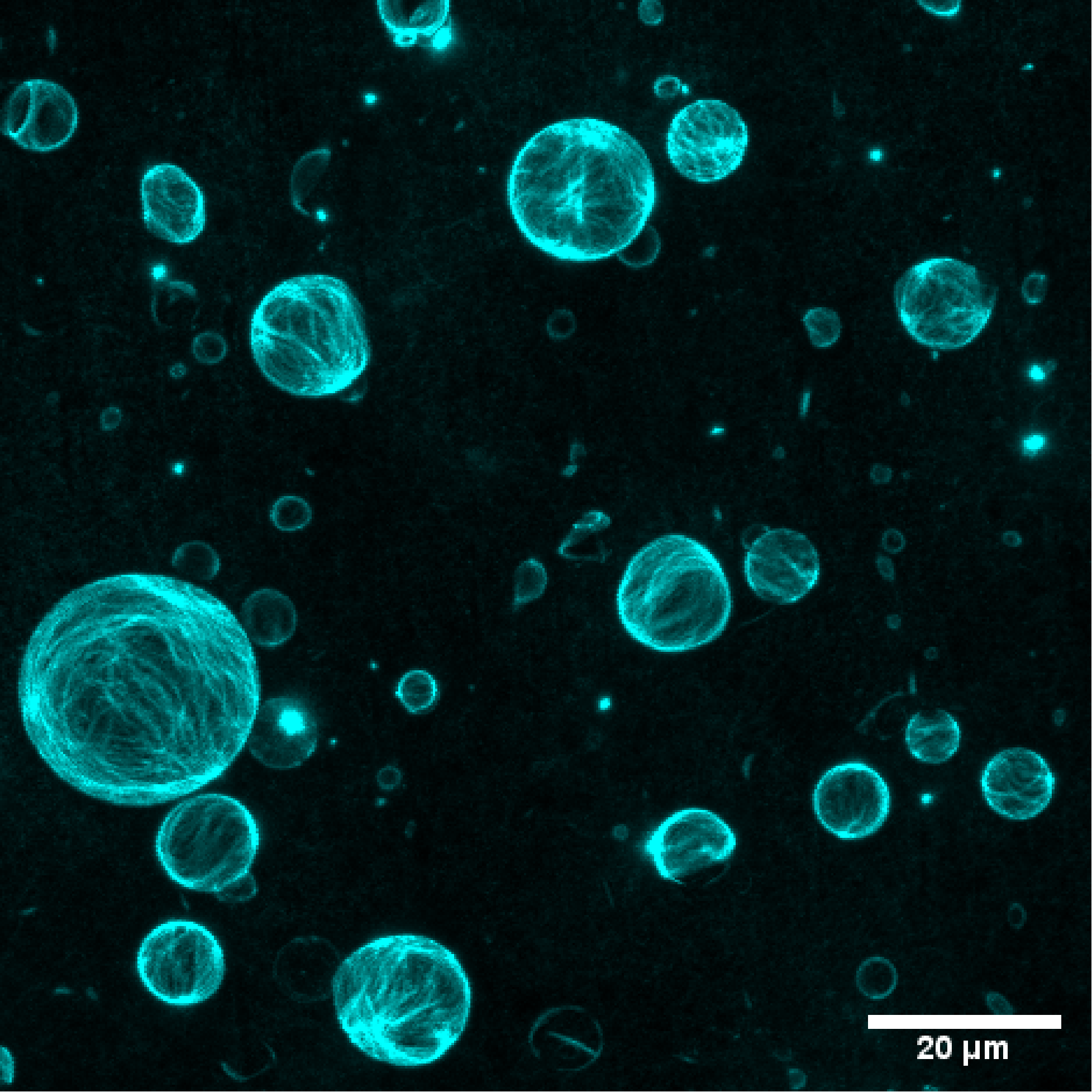 What do the cytoskeleton and a tent have in common? Interview with Philip Bleicher