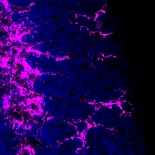 glia3.jpg