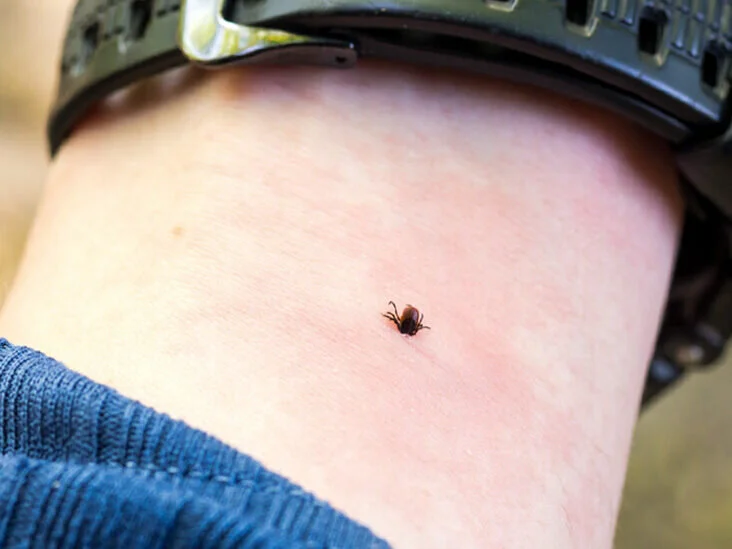 Protect Yourself from Tick Bites and Lyme Disease