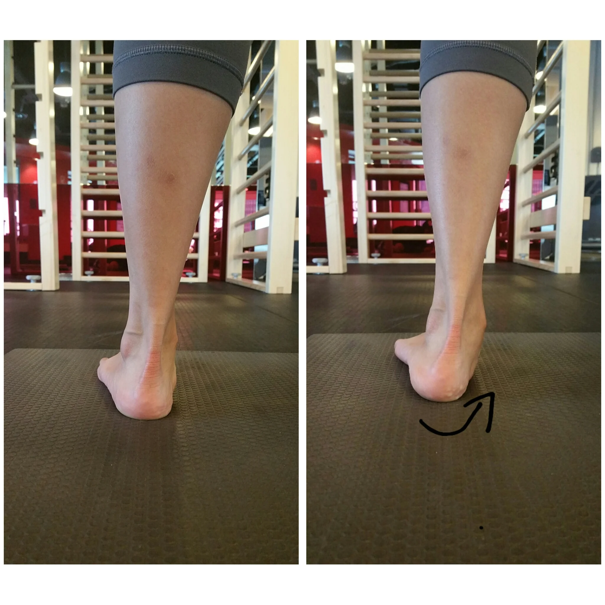(i) Ankles- when you walk do your feet cave inward i.e. towards your big toes, resulting in knees turning inward?
