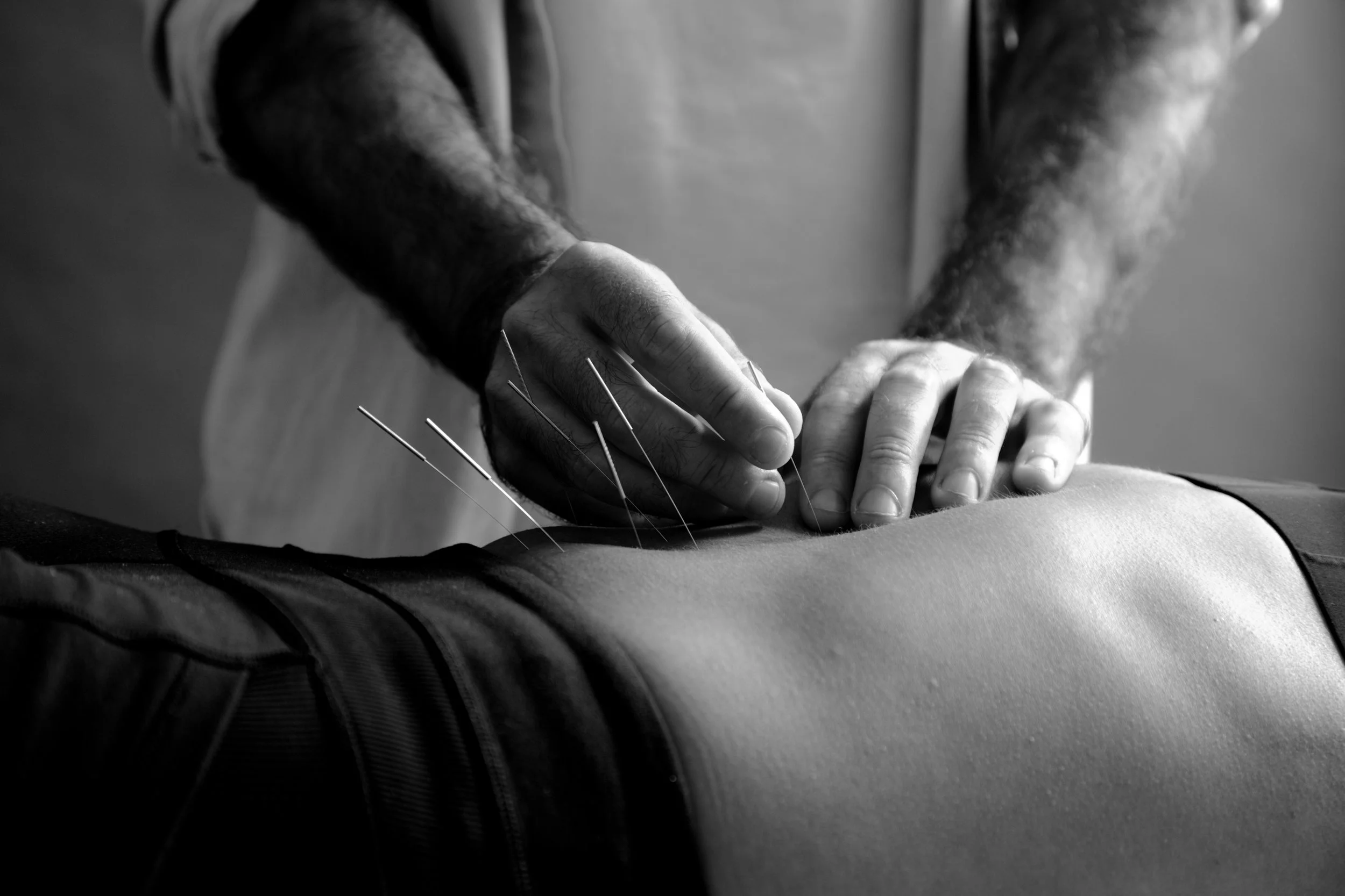CarlyGaebe_MichaelKabram_Acupuncture-CarlyGaebe_MichaelKabram_Acupuncture-Brooklyn-Cupping-massage-yoga-back pain-pain-neckpain-dancer-parkslope-wellness35 (1).jpg