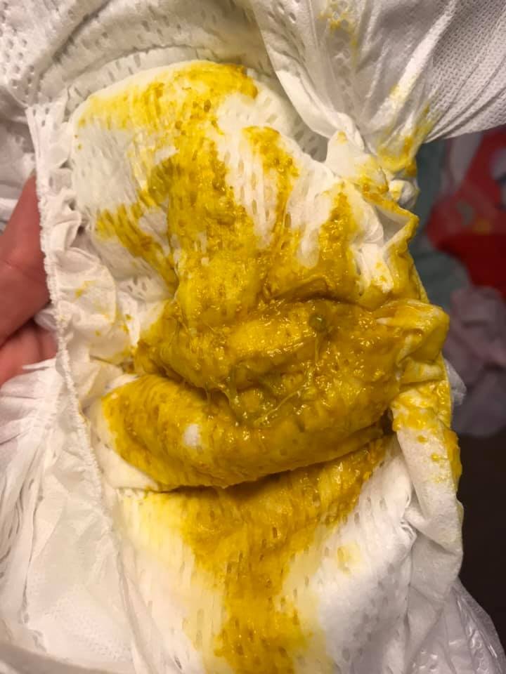 yellow mucus in stool