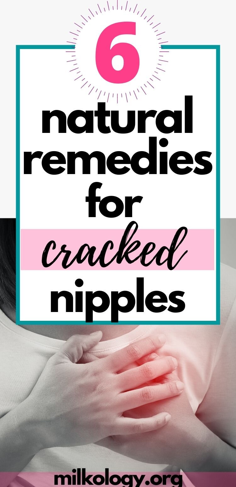6 Home Remedies For Sore, Cracked Nipples — Milkology®
