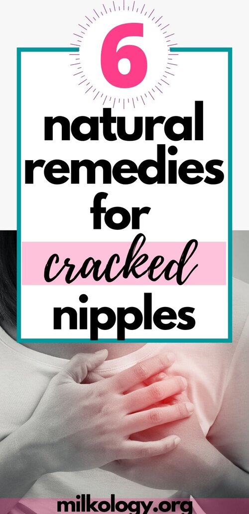 How to Soothe Your Cracked Nipples 