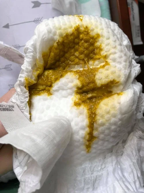 Breastfed Baby Poop Mucus Pictures — Milkology®