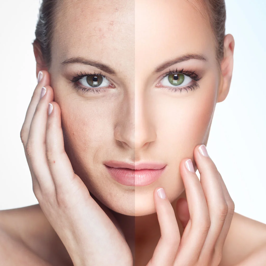 Verso-Surgery-Centre-ipl-photofacial.jpg