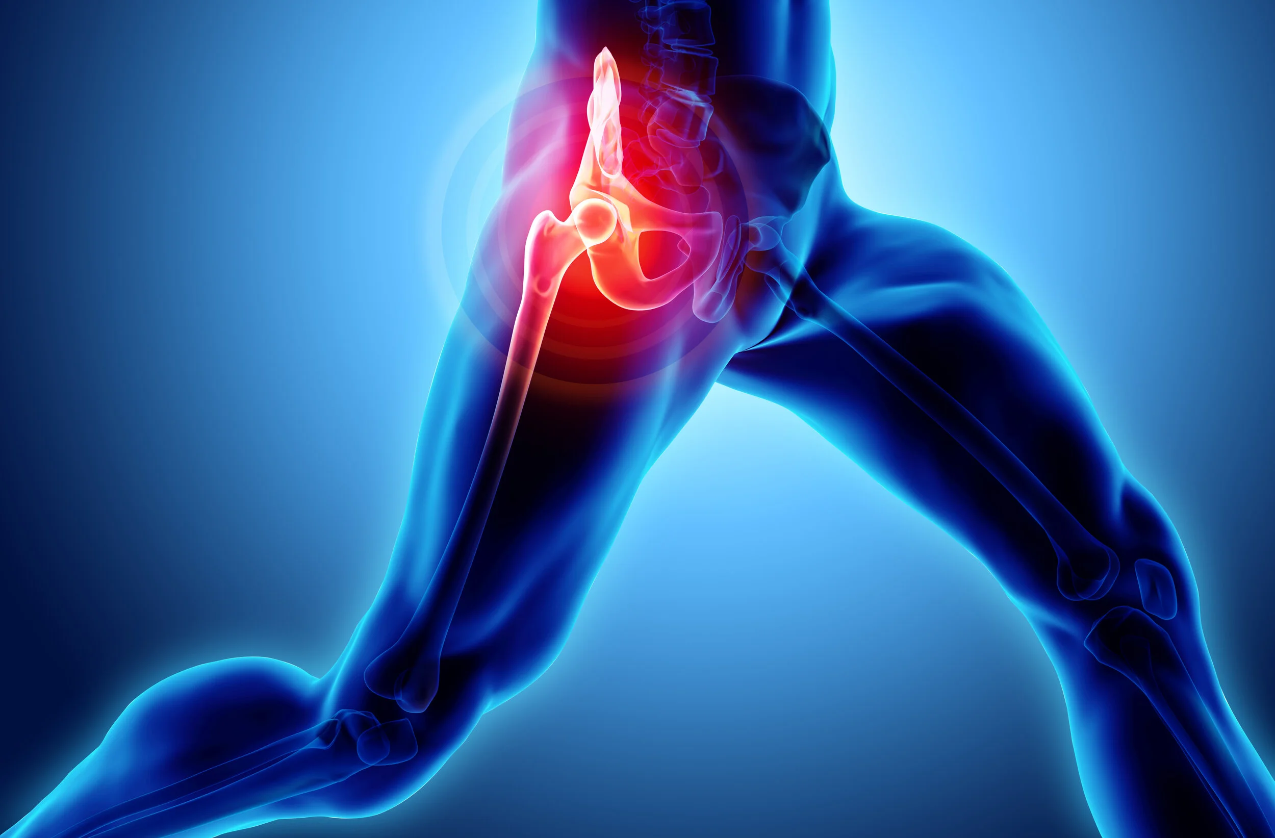 John Hip Replacement Recovery