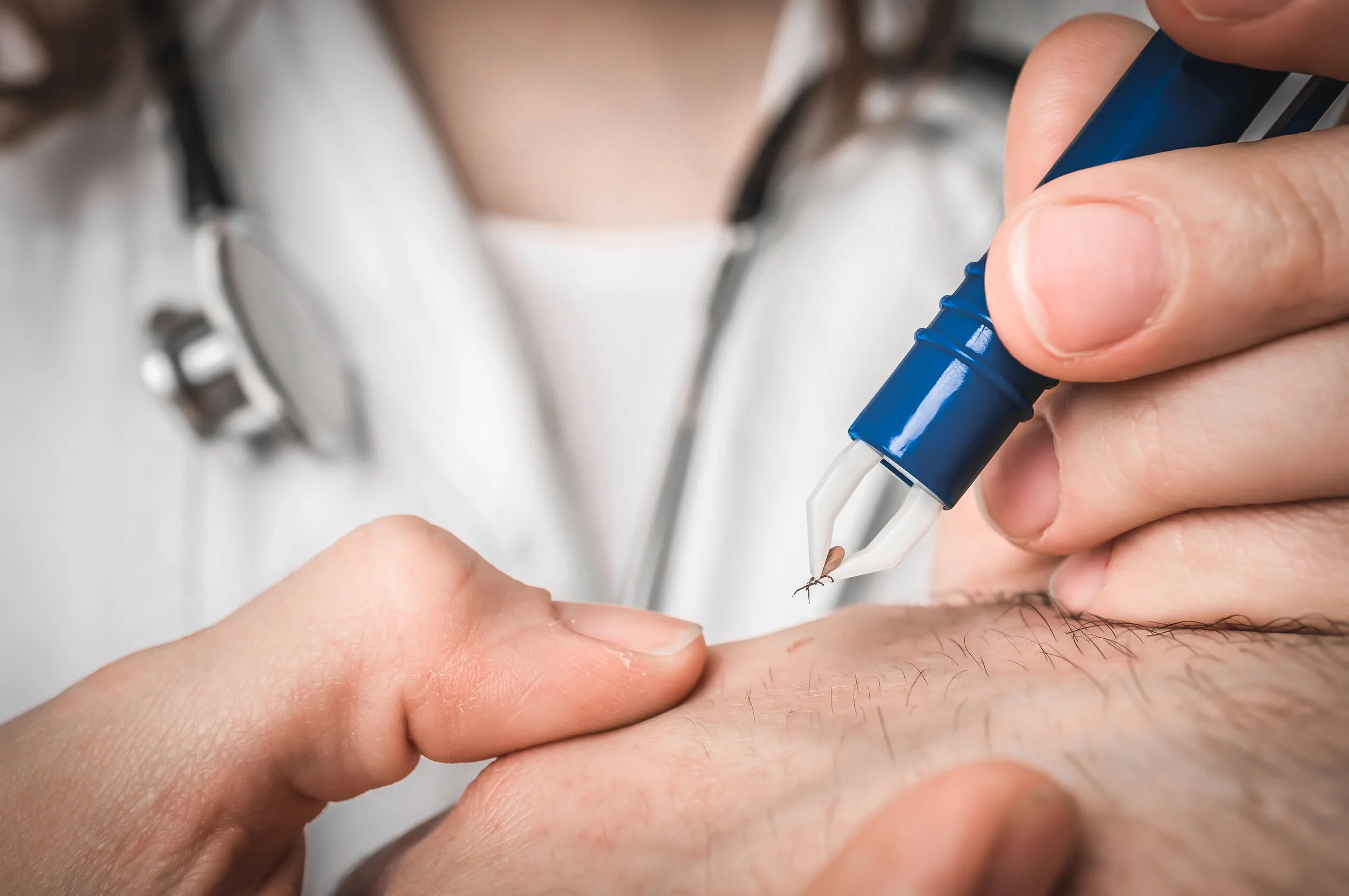 HBOT &amp; Lyme Disease