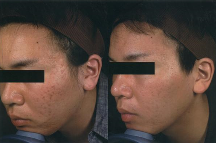 fsr_full_face_1.png