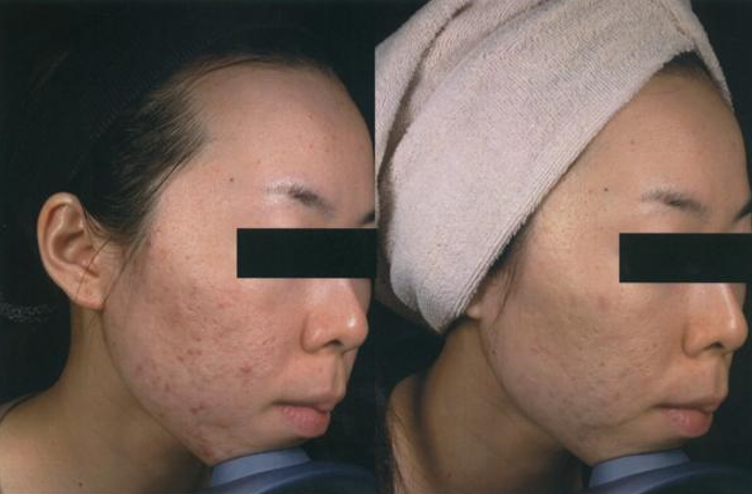 fsr_full_face_2.png