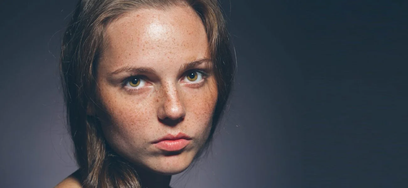  Pigmentation 