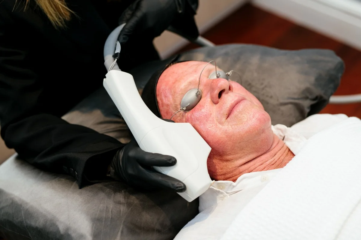 BBL Photorejuvenation on male