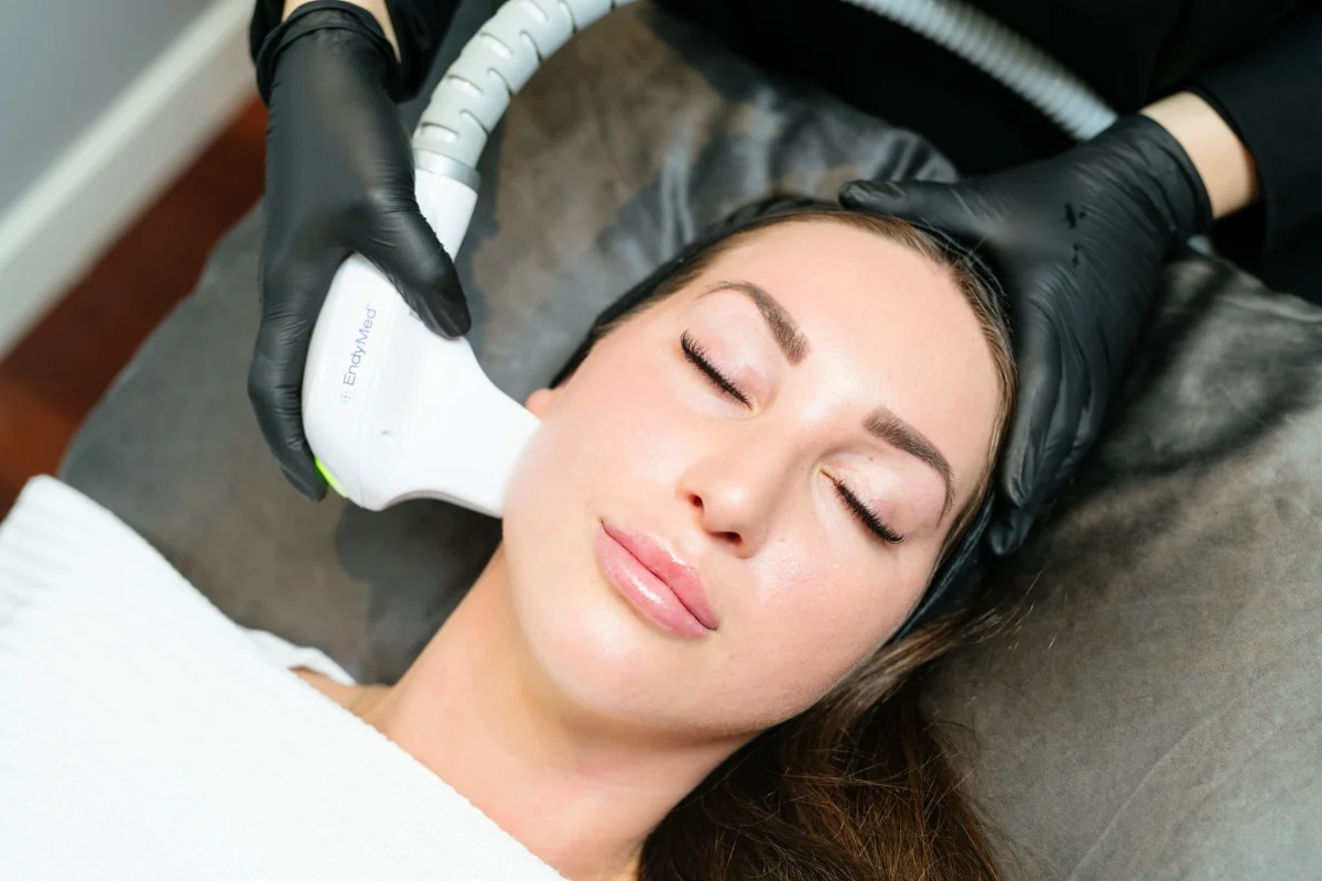 RF Skin Tightening on female