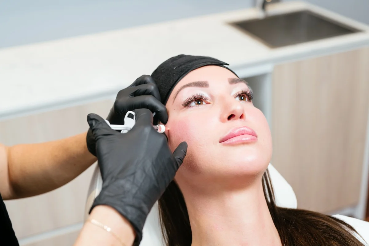 cheek filler injection by Dr Kate
