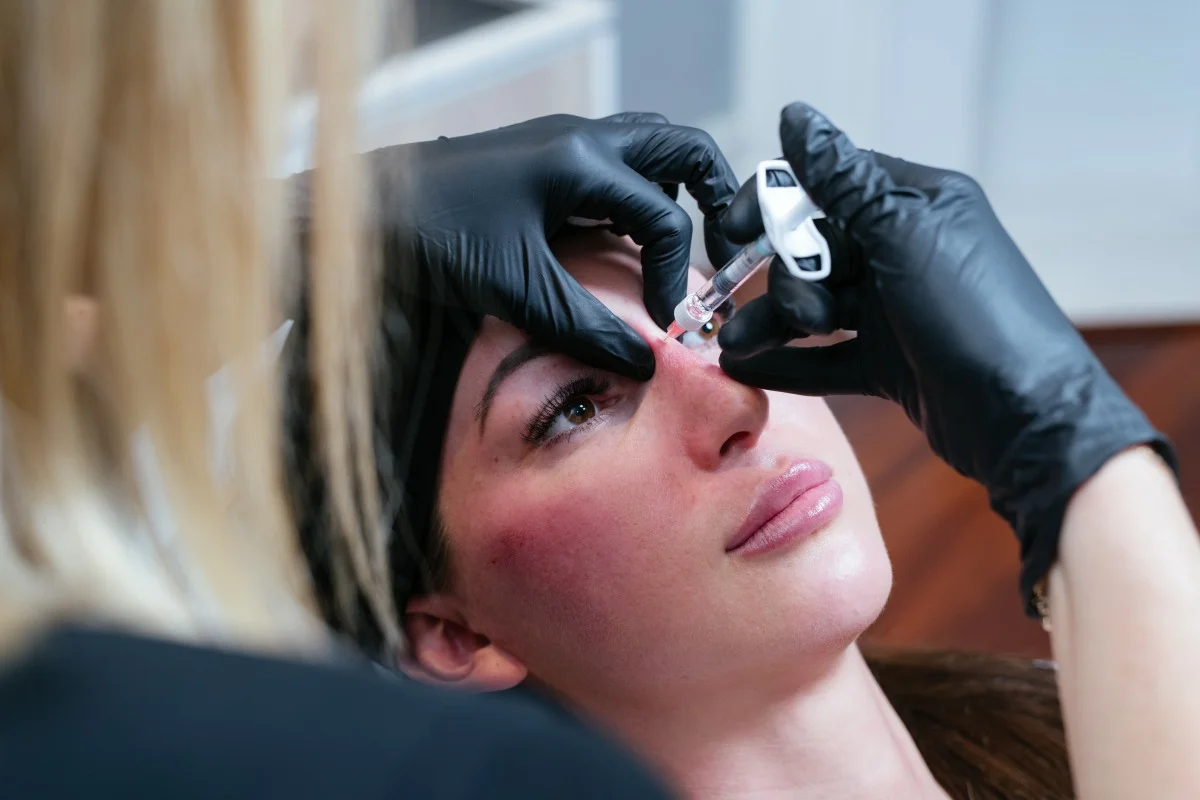 Dr Kate performing rhinoplasty
