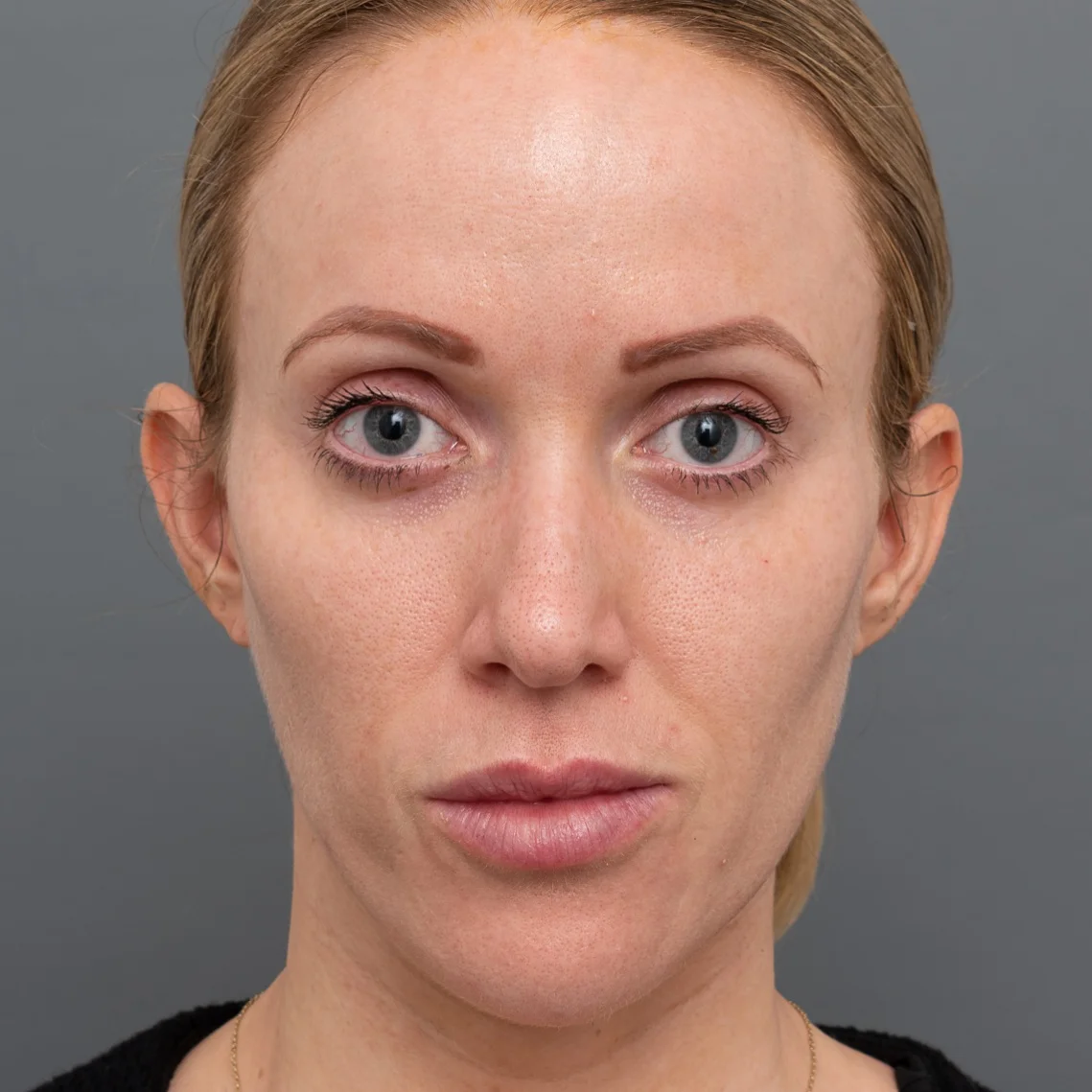 Halo Recovery Timeline — Youth Lab, Perth