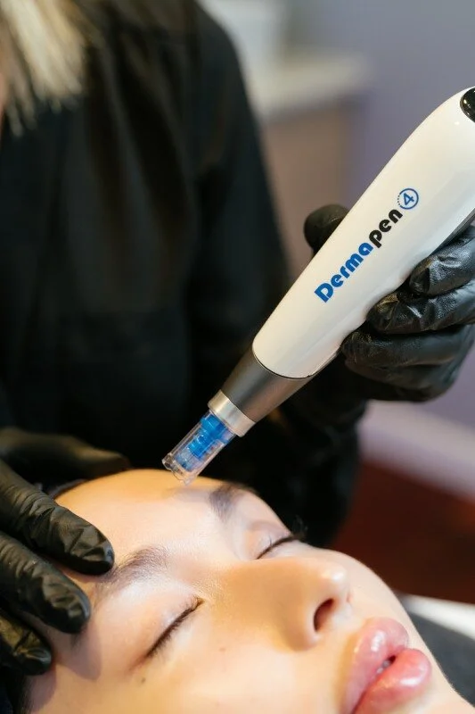 dermapen4 close up