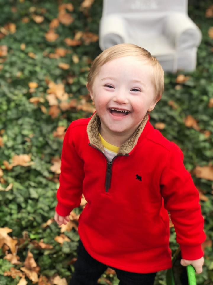 Mosaic Down Syndrome