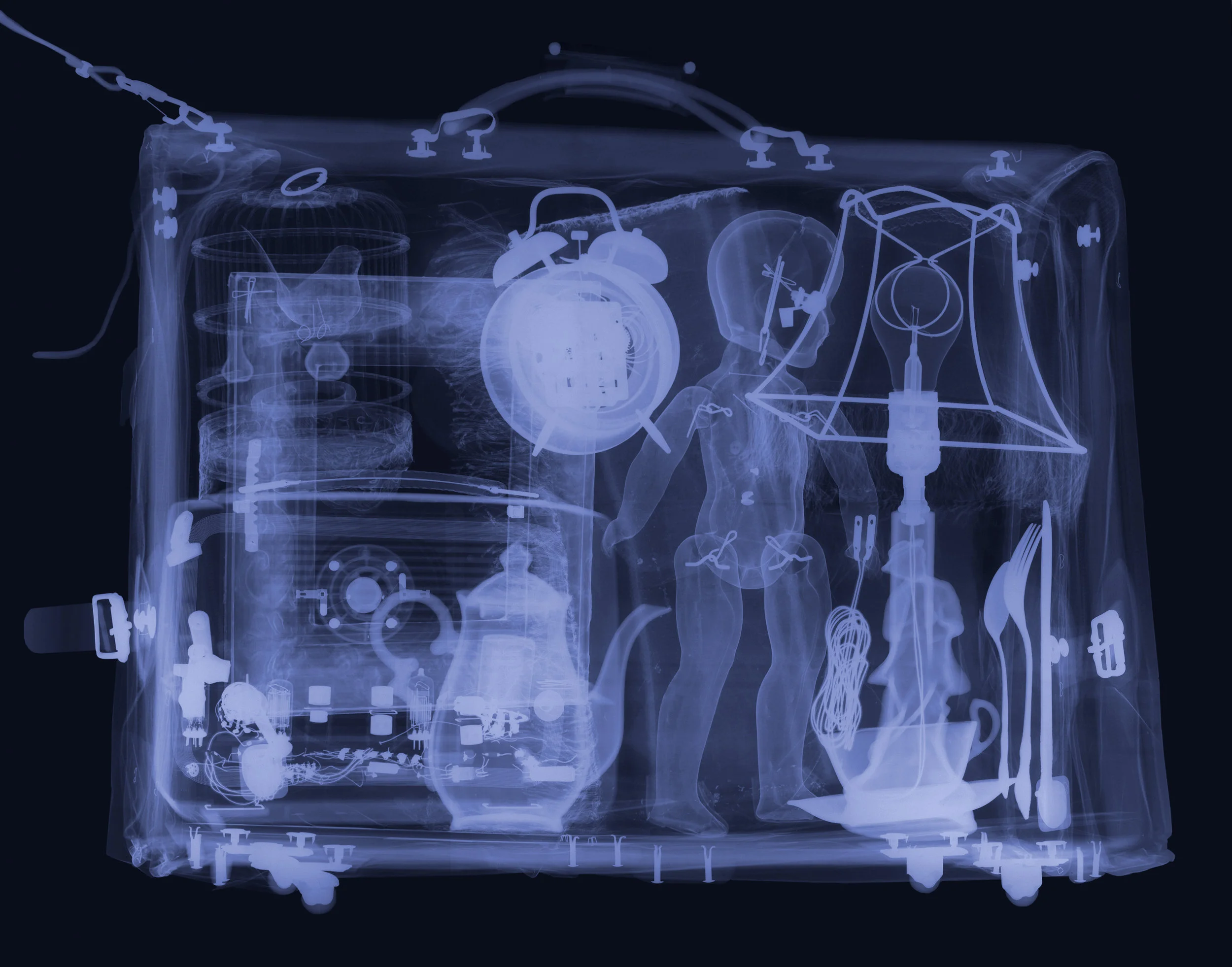 xray adjusted.jpg