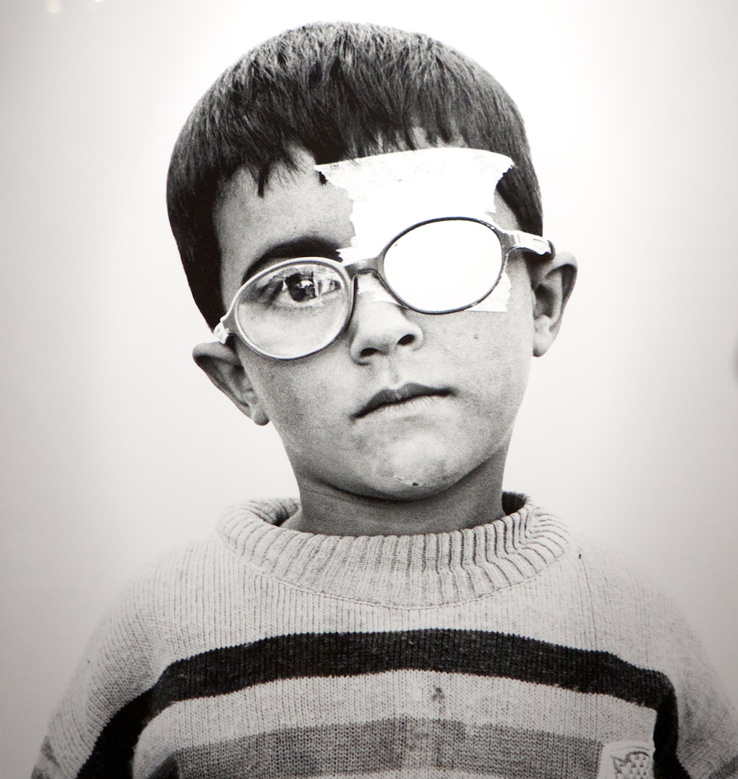 Portrait of Murad from Giles Duley's exhibition "I Can Only Tell You What My Eyes See"