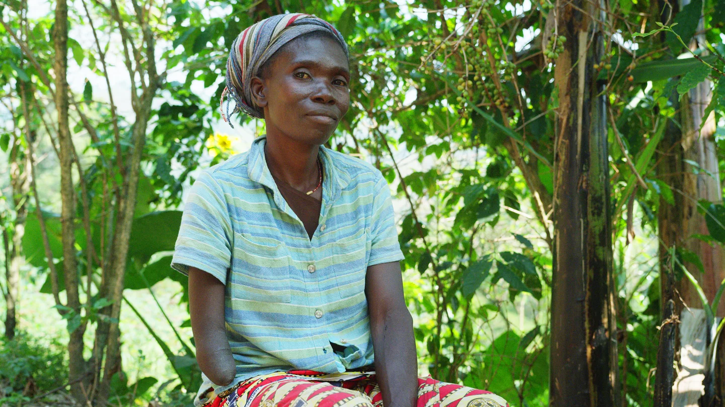 Cifa, a 38 year old coffee producer and ERW survivor, has a below elbow amputation on her right arm. She is married with three children who all work the farm because she does not have enough money to pay for their education.
