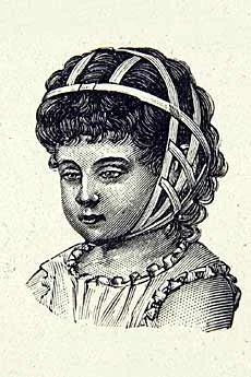 Ce type de bandage était utilisé pour redresser les oreilles de l’enfant