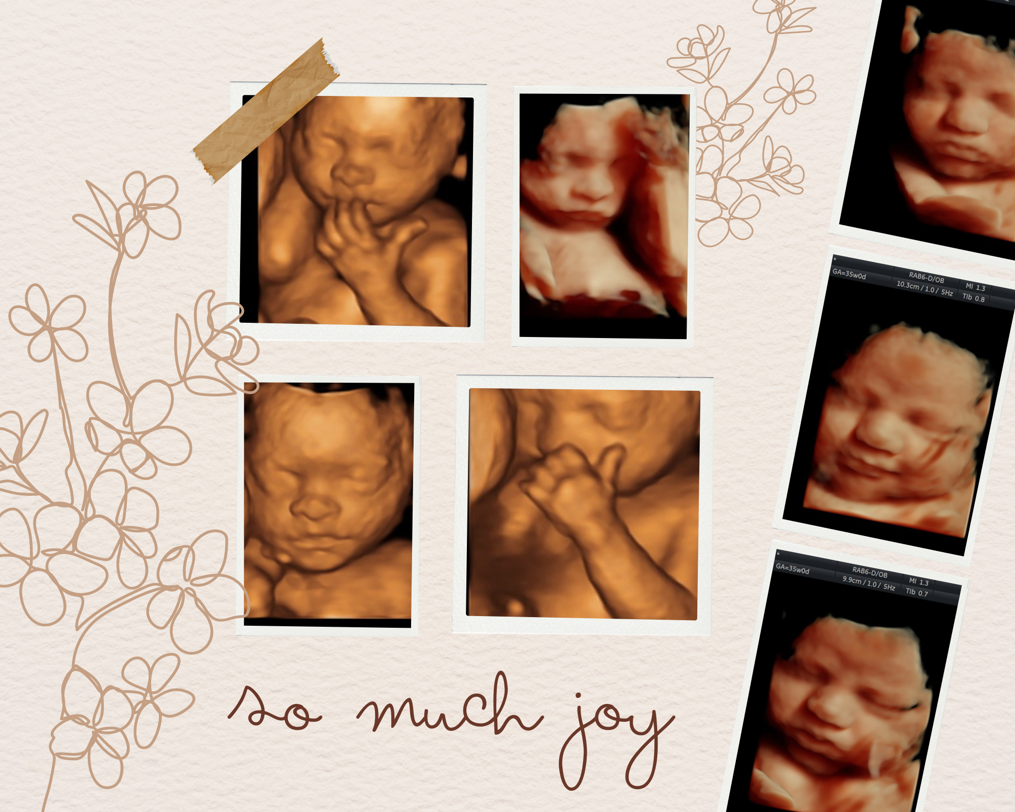 Peek-A-Boo Baby Logo