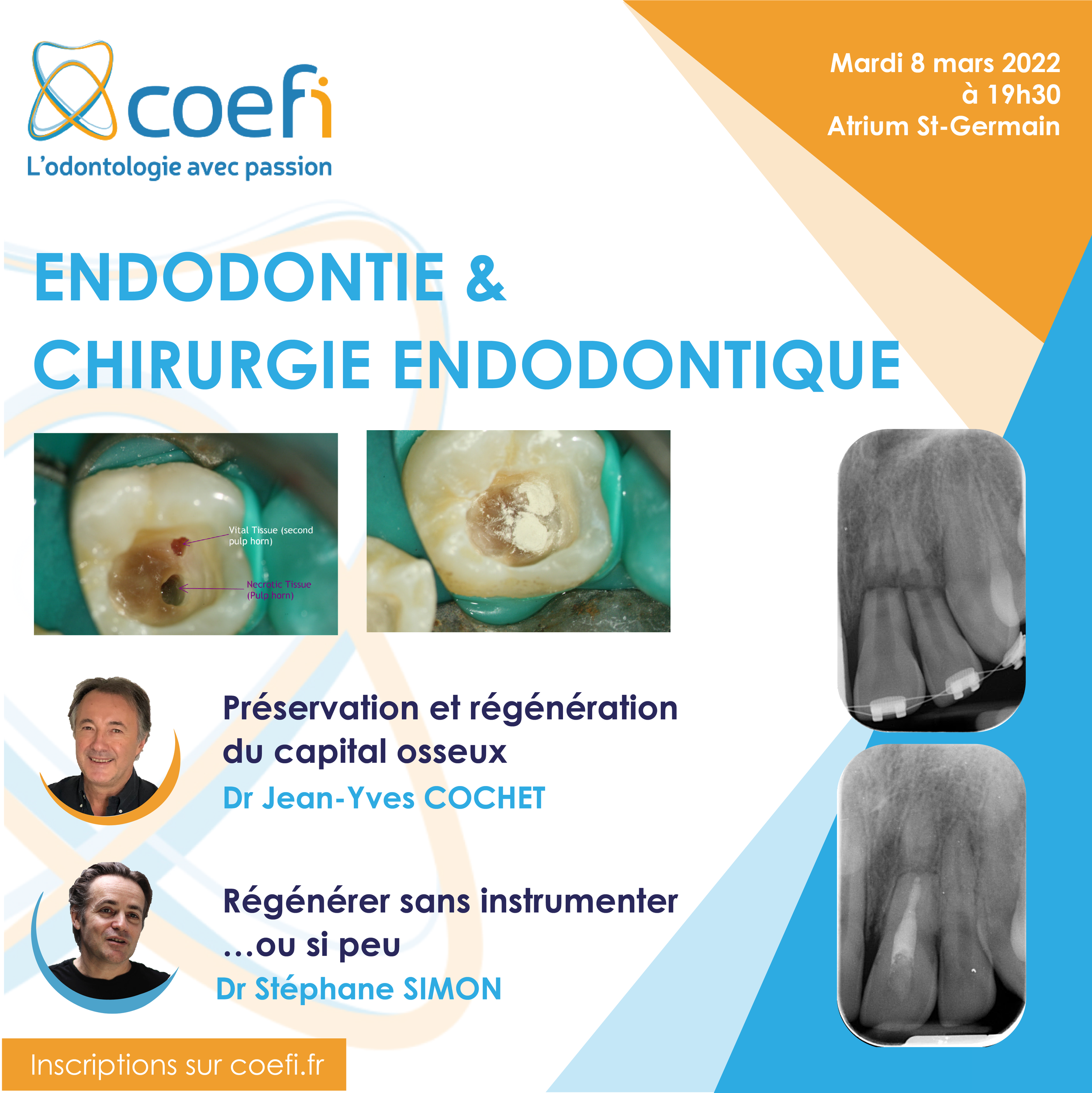 visuel carre endodontie 8 mars.png