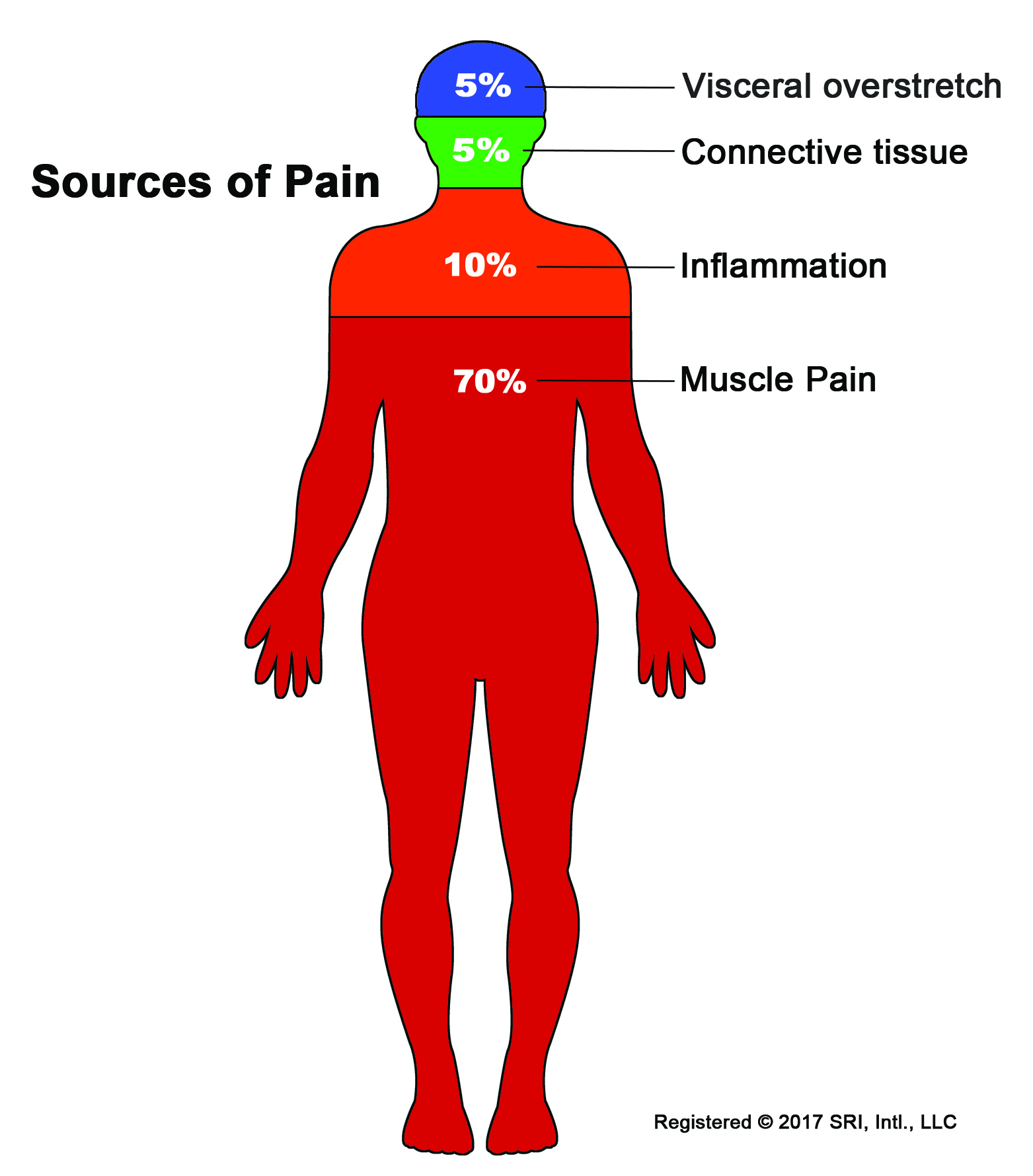 Sources-of-Pain-Body-Graphic.jpg
