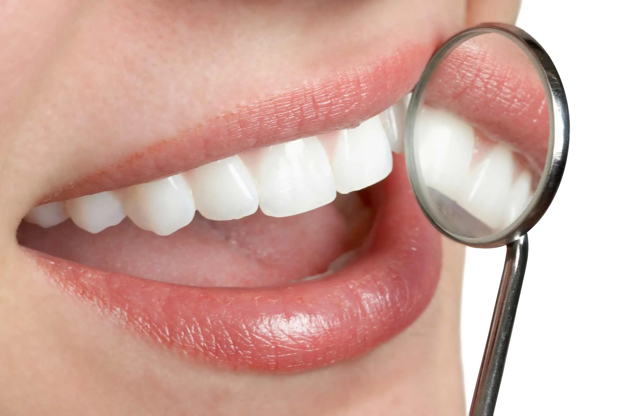 Teeth whitening is a non-invasive procedure that can help your teeth appear whiter, brighter and younger.