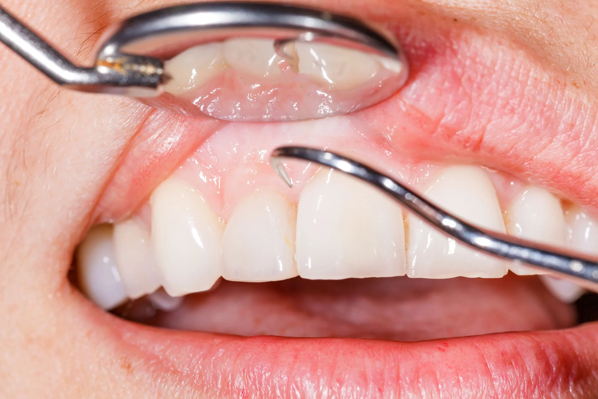 bigstock-Dental-Examination-72385855WEB.jpg