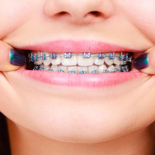 Specialist Orthodontics