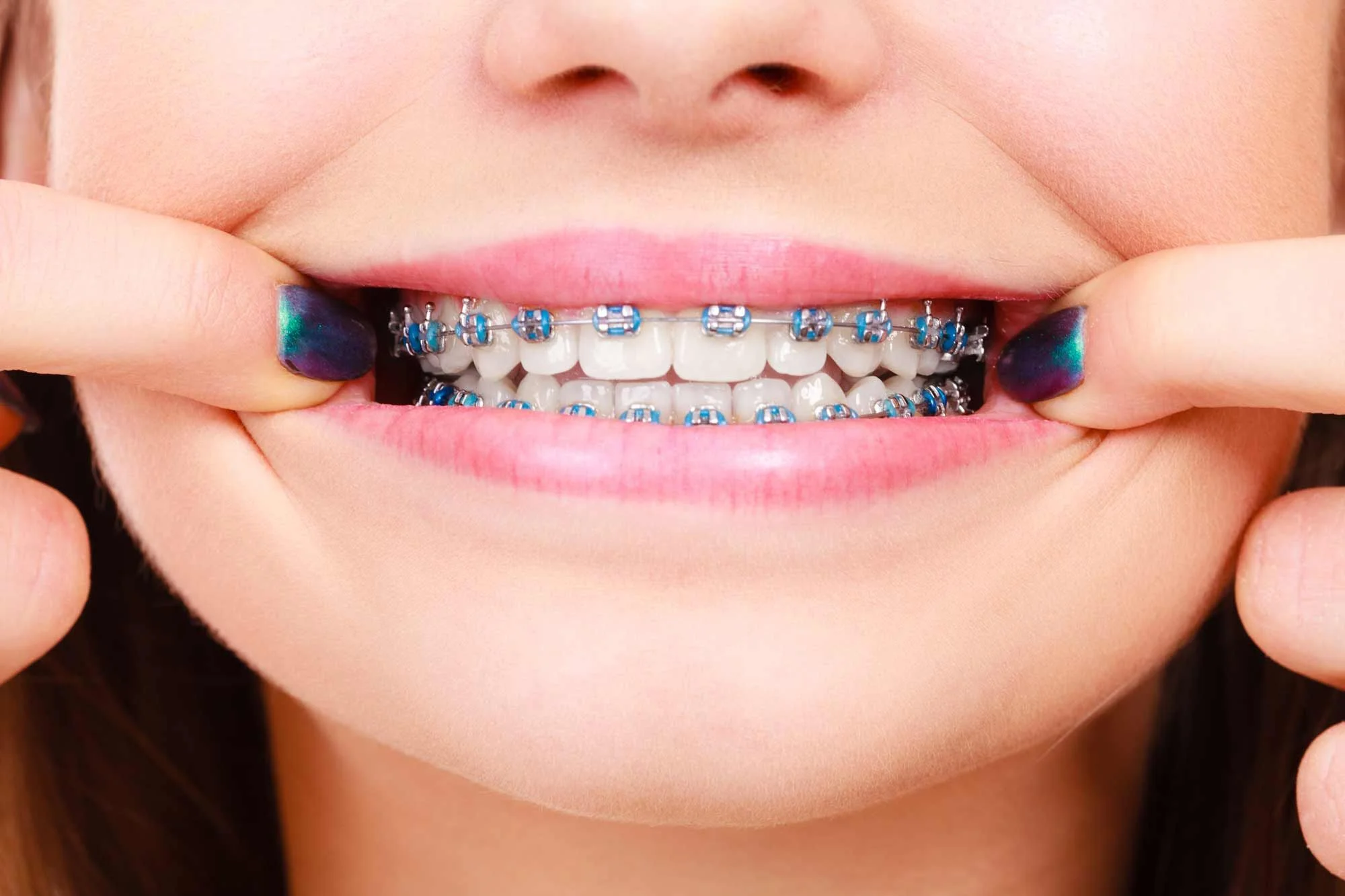 Orthodontics