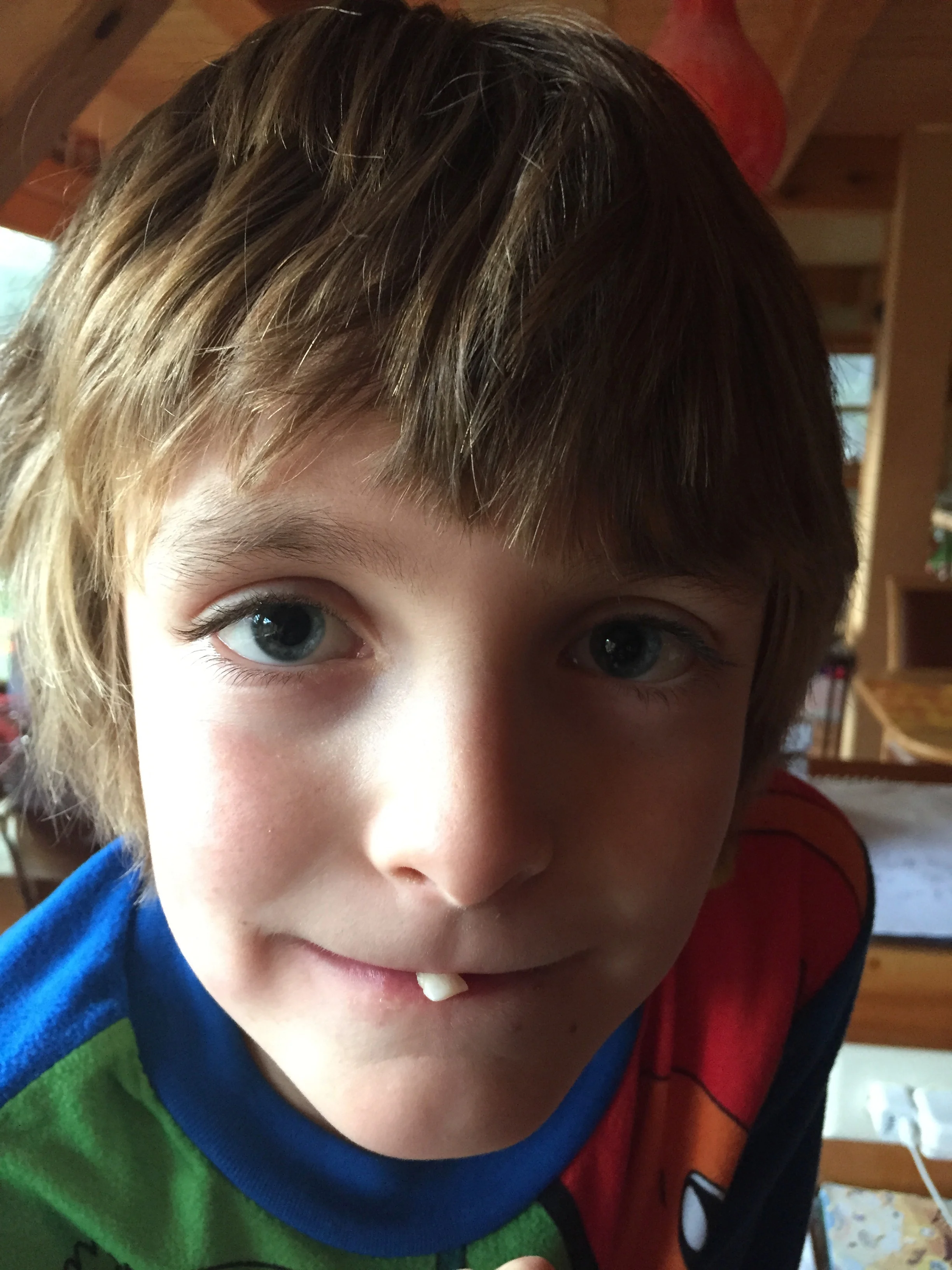  The Tooth Fairy Needs a Loan