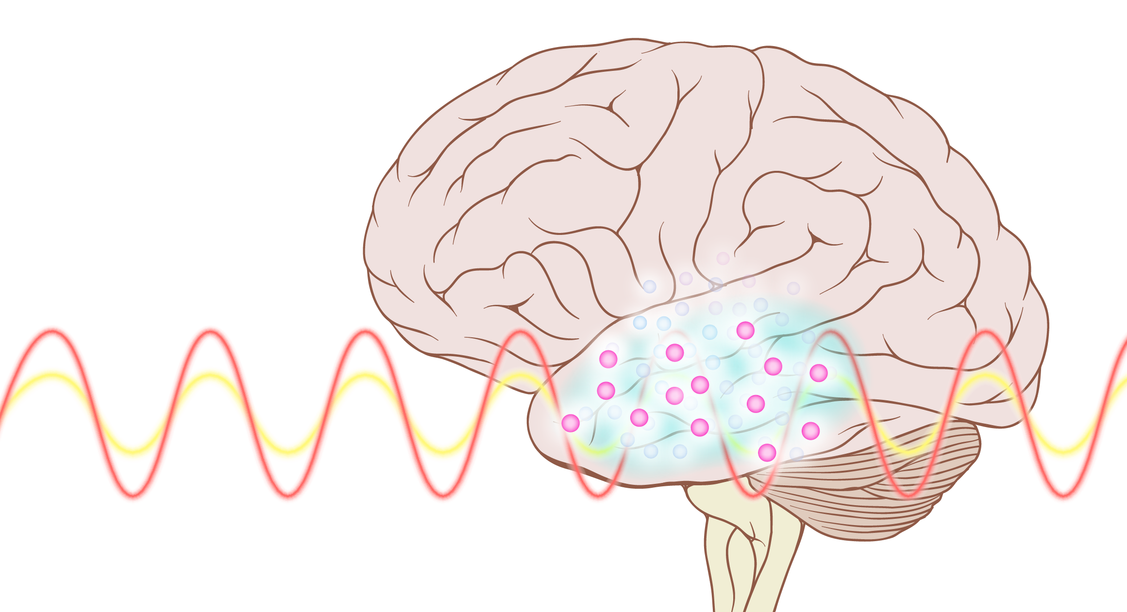 Non-Invasive Deep Brain Stimulation