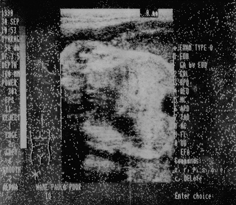 3 ultrasound.jpg