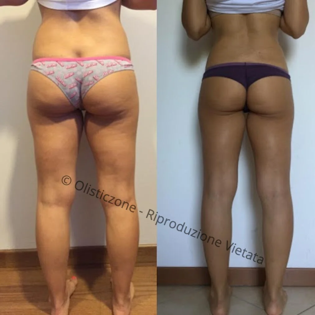 LPG_OZONECOSMETICS_PRIMAeDOPO_Francesca_S_Watermark3.jpg