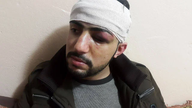 Kurdish Journalist Apprehended and Beaten