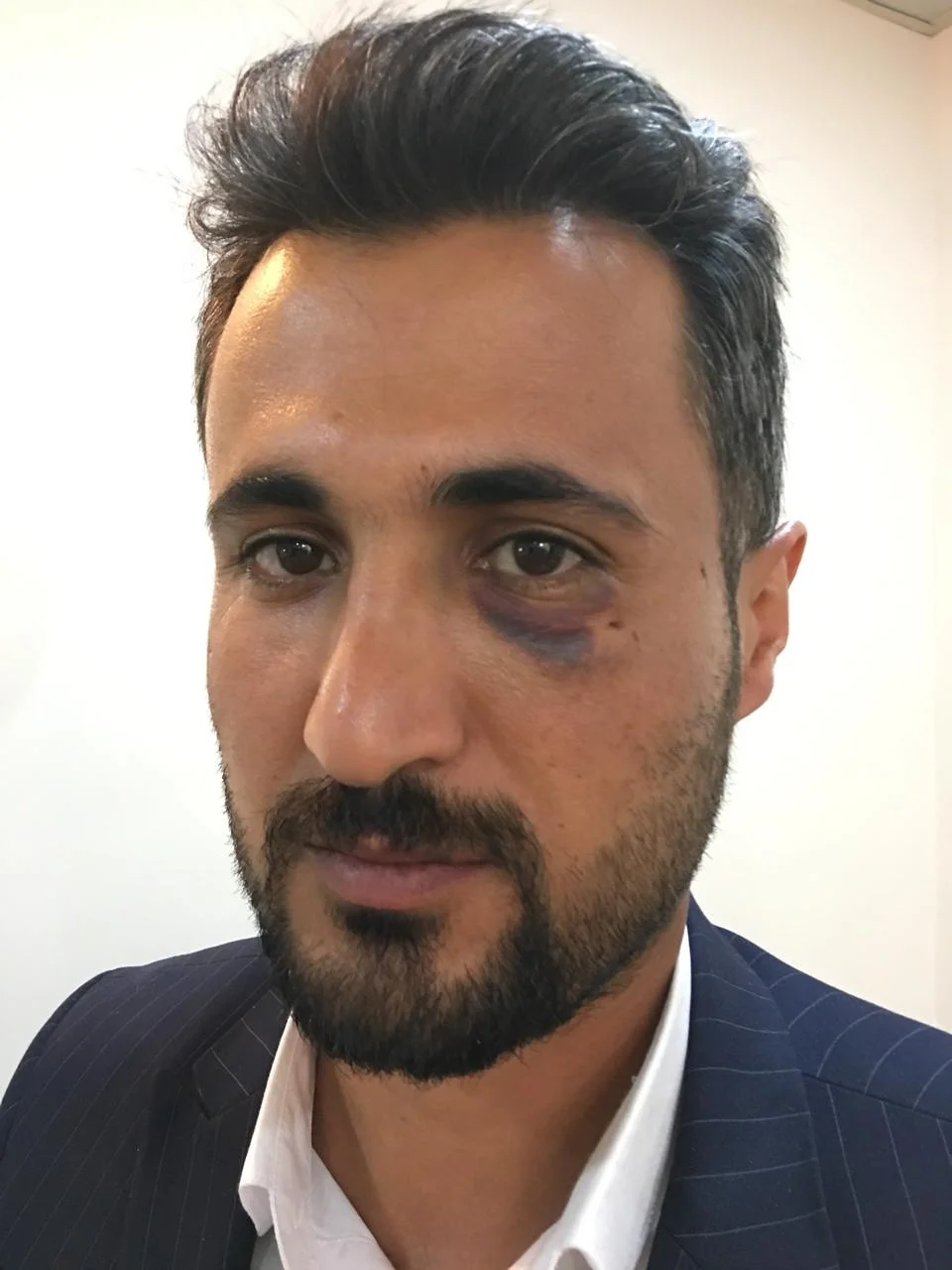  من دەمەوێت دەنگ بدەم، وە هەرگیز دەستبەرداری ئەوە نابم