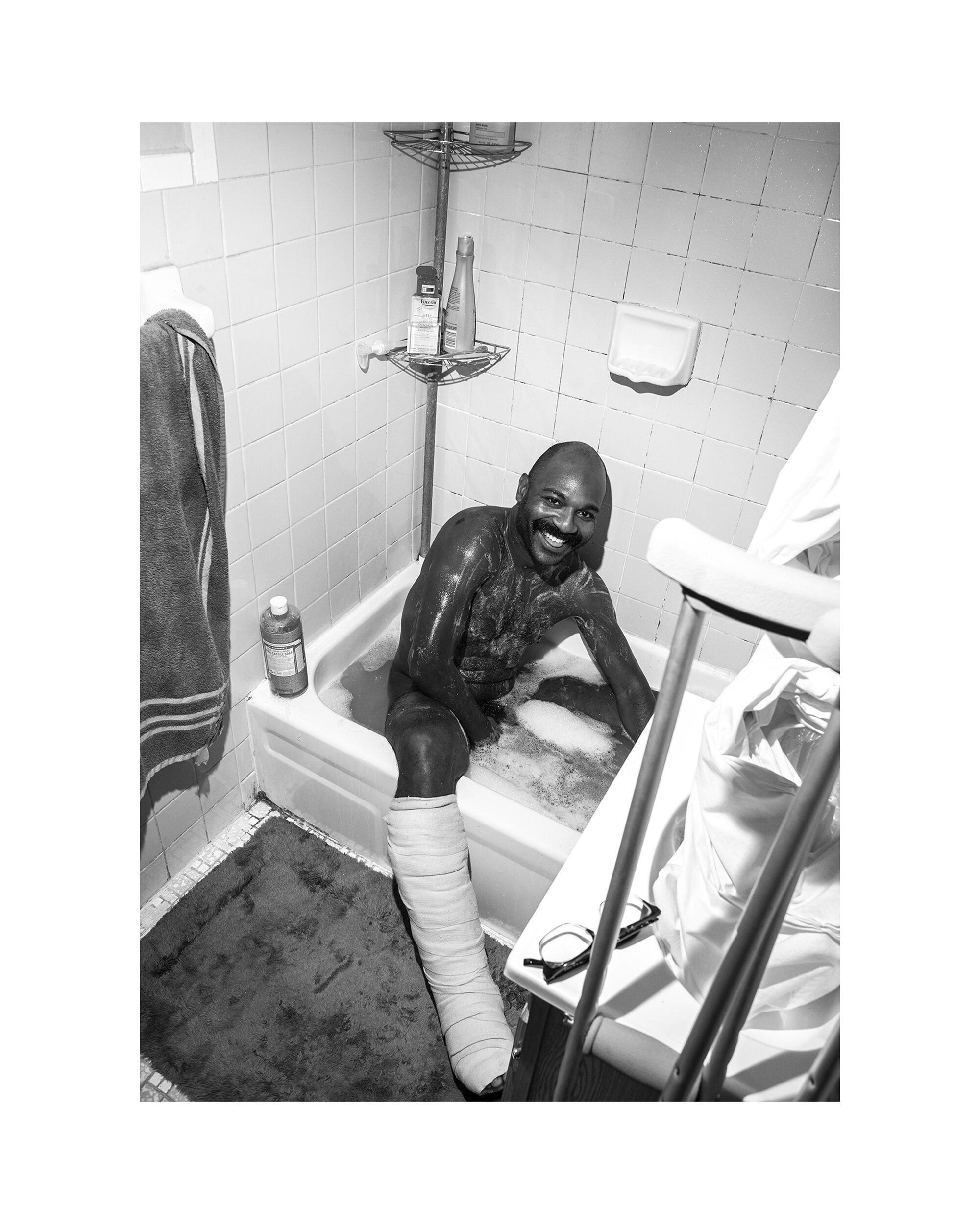   Eddie After Surgery (Queens)  