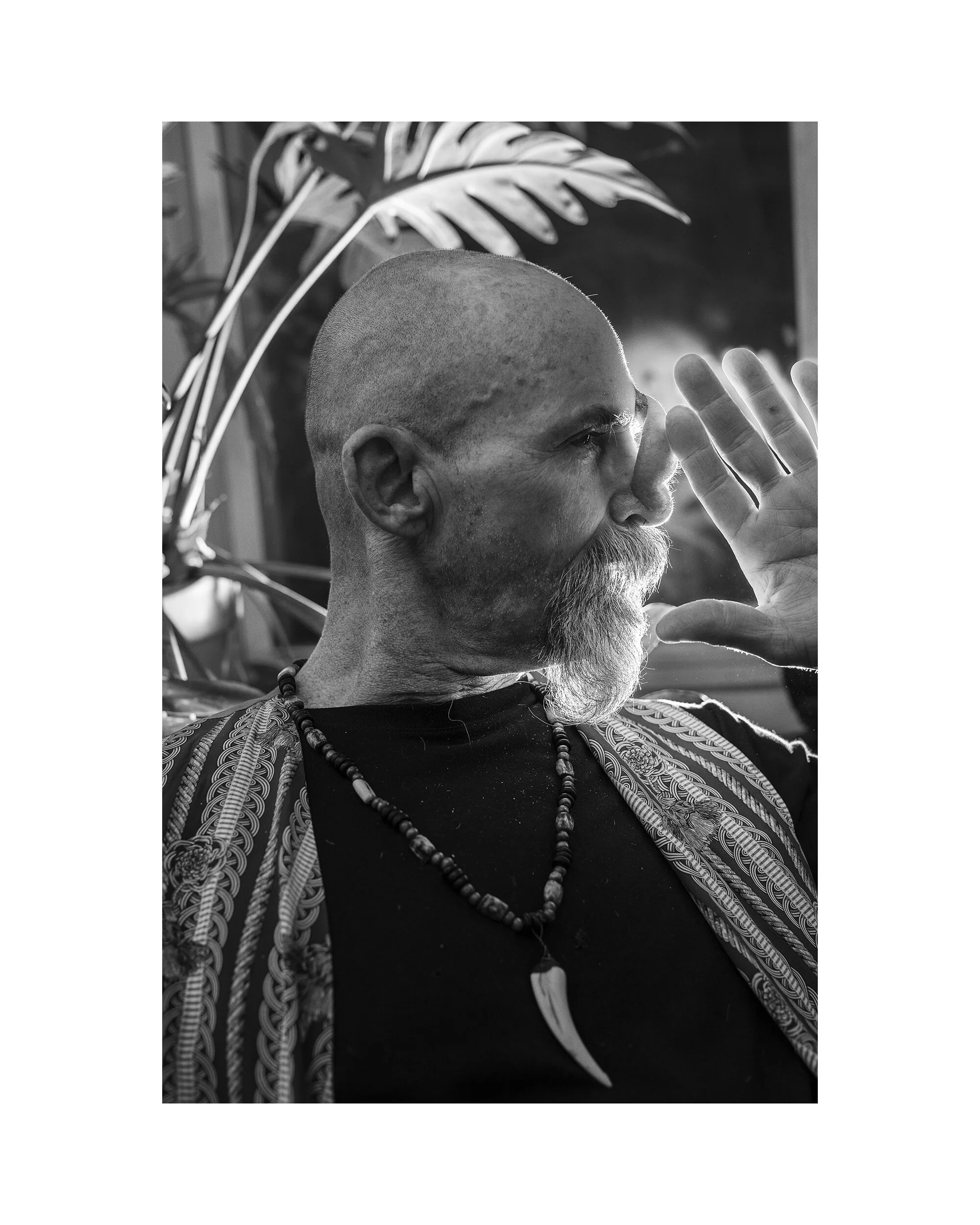   Hunter Reynolds at Home/Skin Graft  