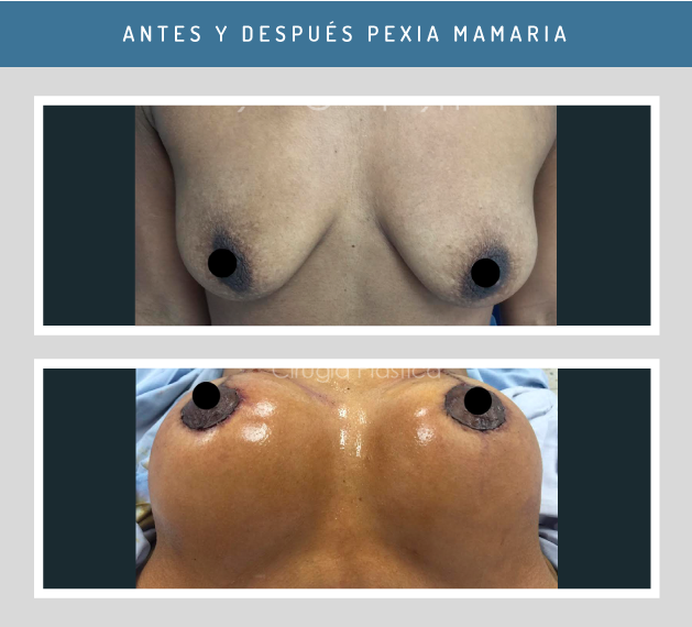 Antes-y-Después4.png