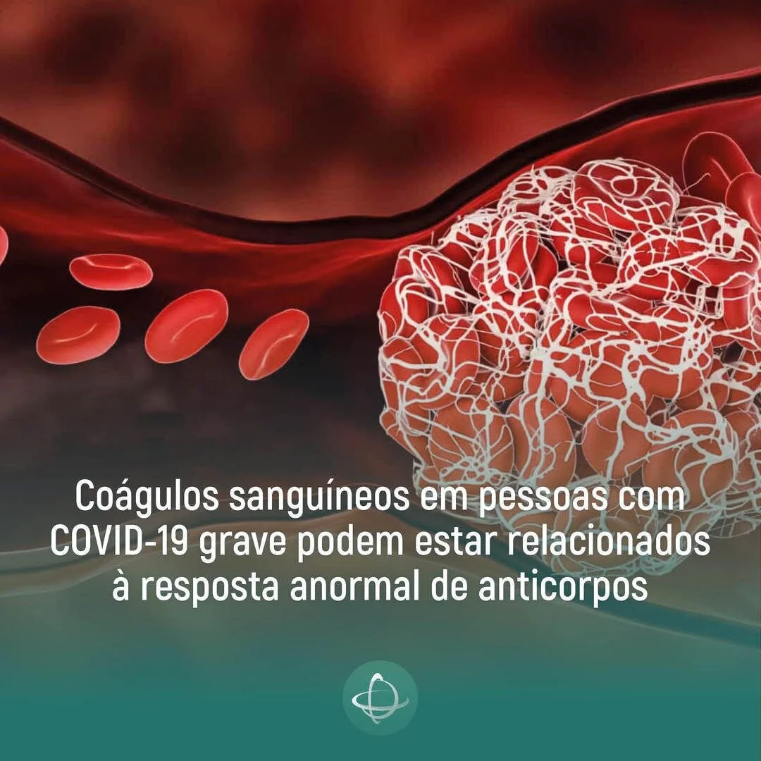 Coágulos sanguíneos em pessoas com COVID-10 grave podem estar relacionados à resposta anormal de anticorpos