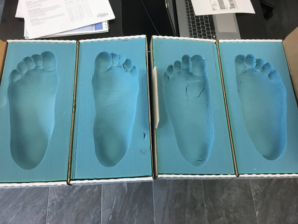 orthotic casts.jpg