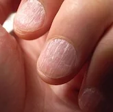 Close-up of fingernails with natural, light-colored nail beds.